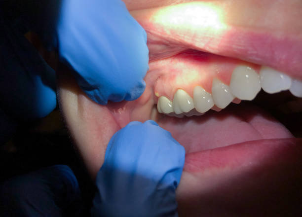 Best Dentist for Severe Toothache  in Bernie, MO