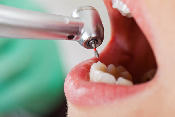 Best Knocked-Out Tooth Emergency  in Bernie, MO